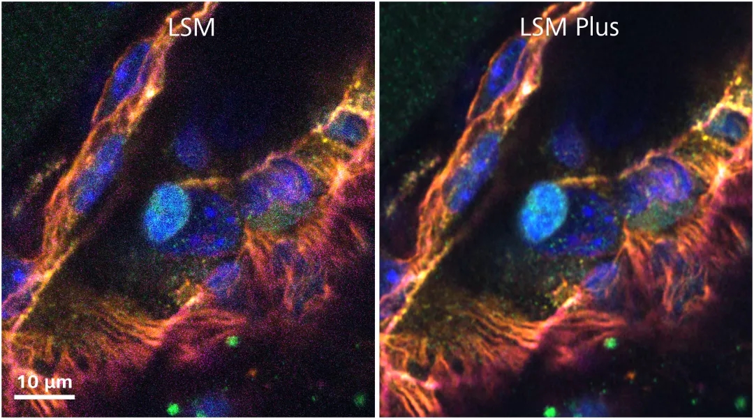 ���۽���΢��